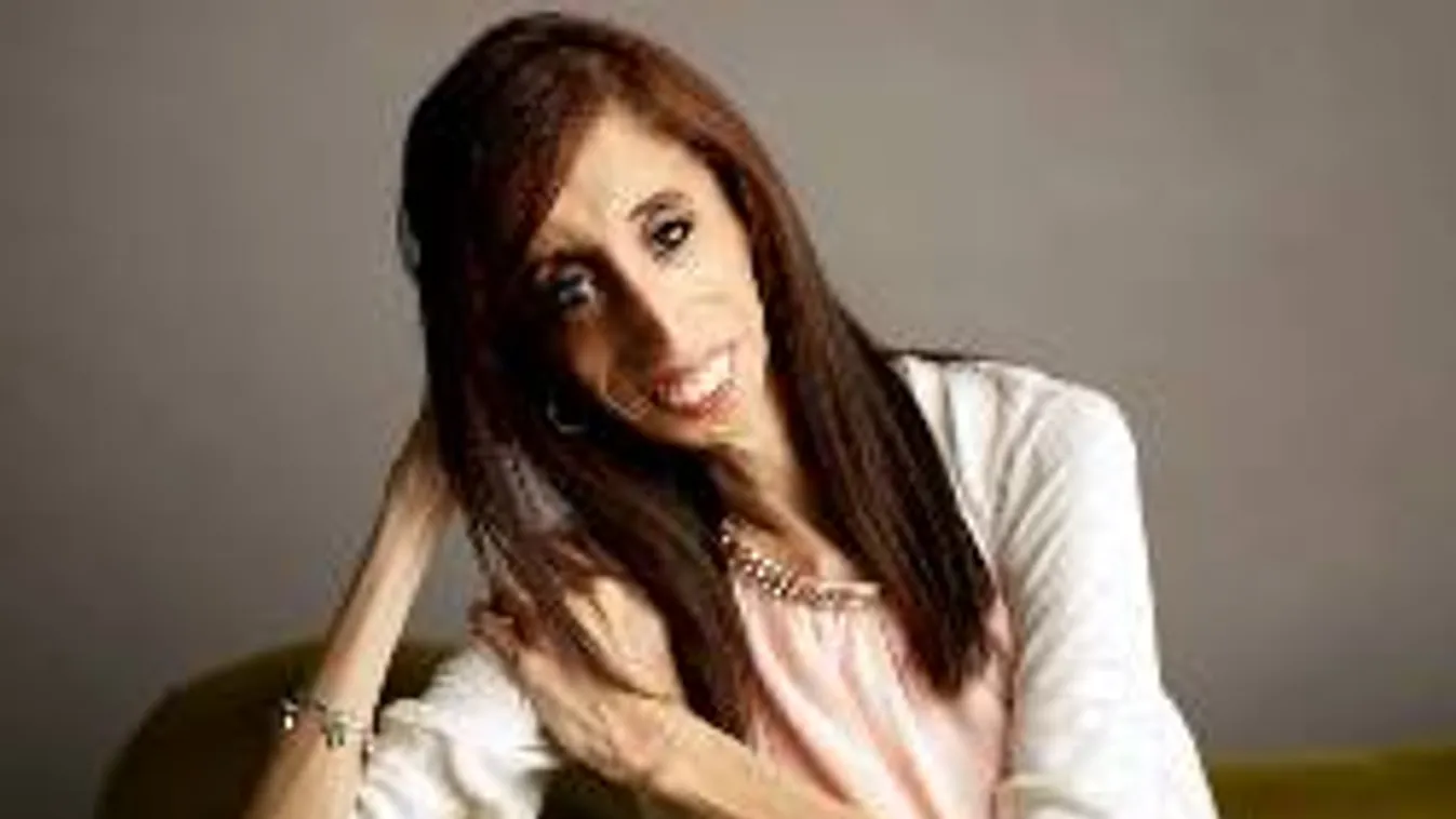 A világ legcsúnyább nőjét sokan imádják!