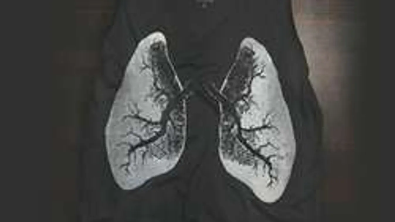 Blokkolja a tüdőrákot a kubai csodagyógyszer!