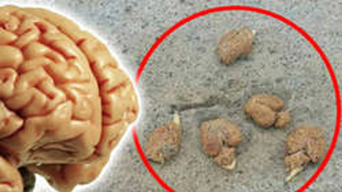 Horror: Kilenc agyvelő hevert az utcán