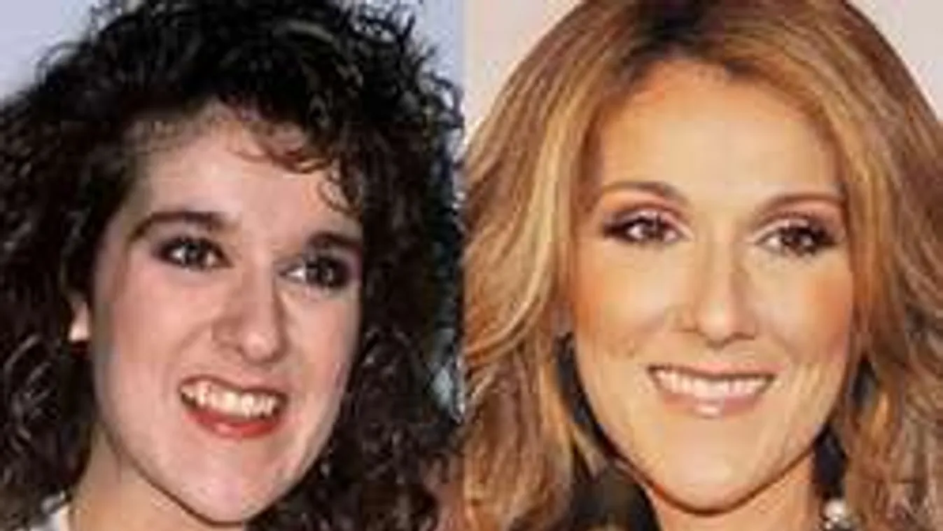 15 sztár, akinek kicserélték az egész fogsorát