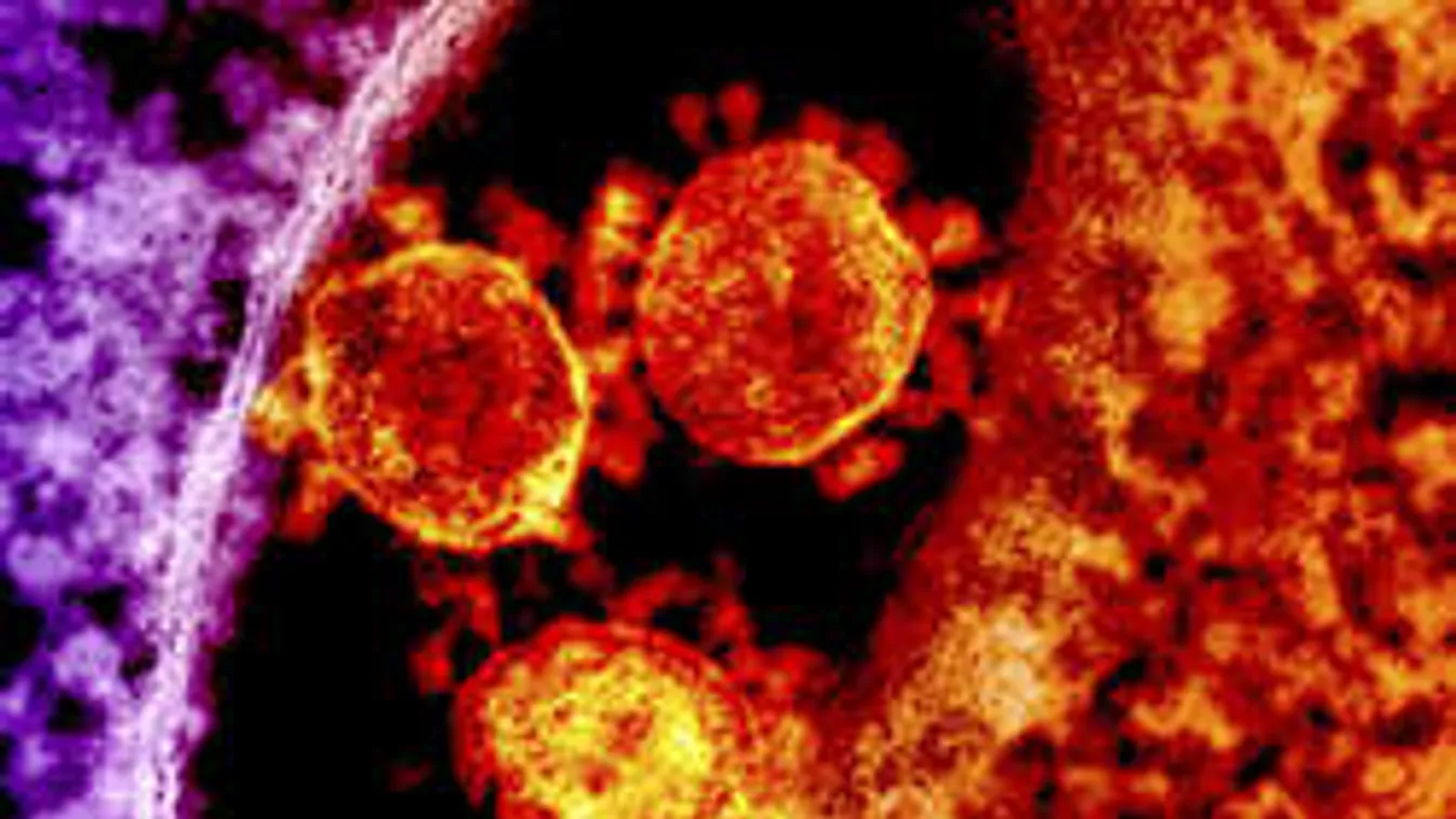 Már Európában is szedi áldozatait a MERS-vírus!