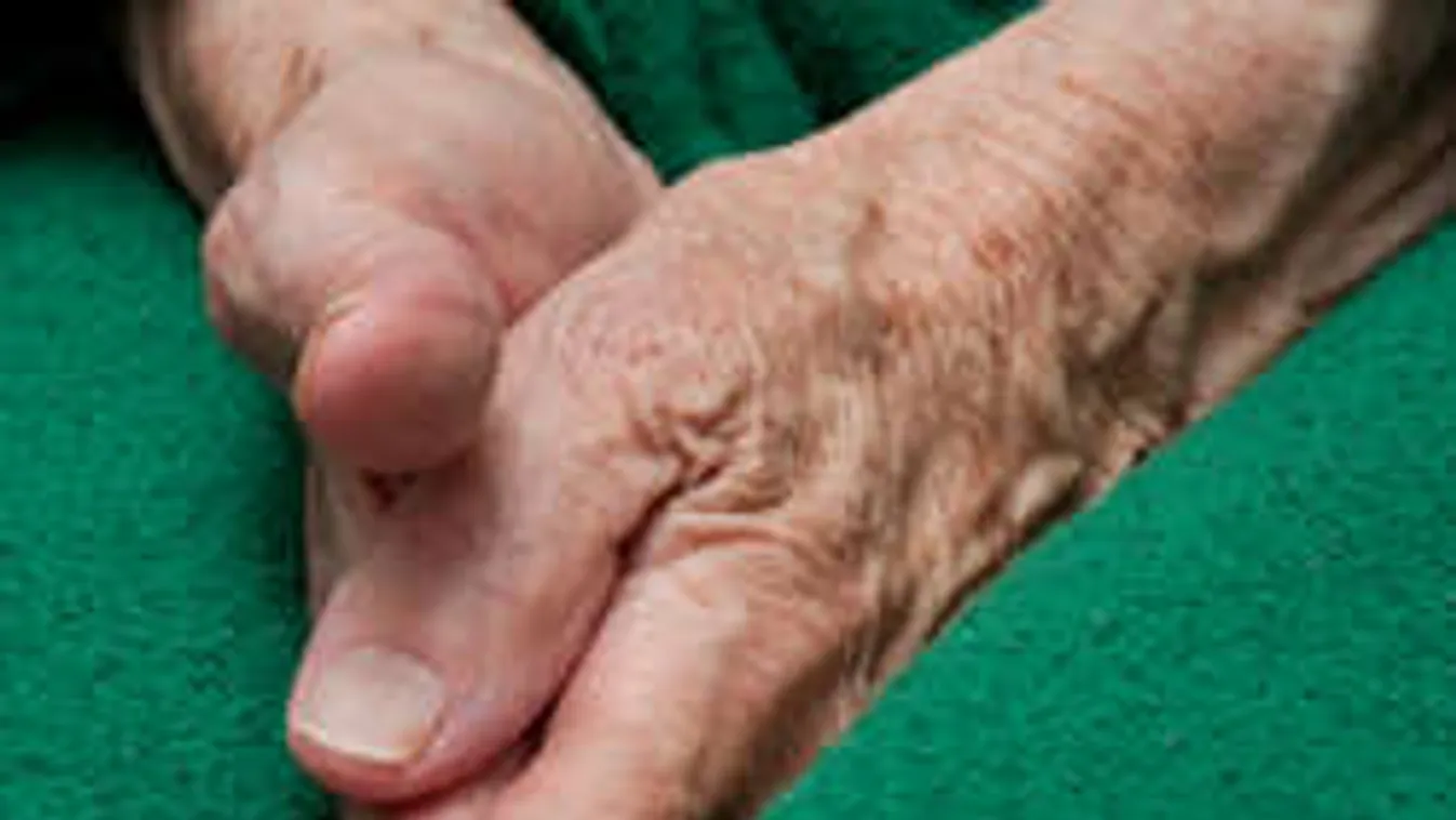 Verést kapott étel helyett az idős asszony