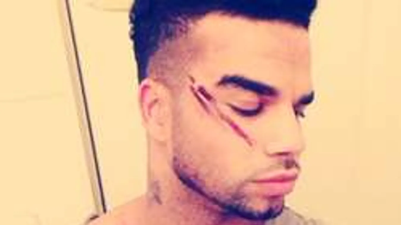 Kállay-Saunders támadója újra lecsapott