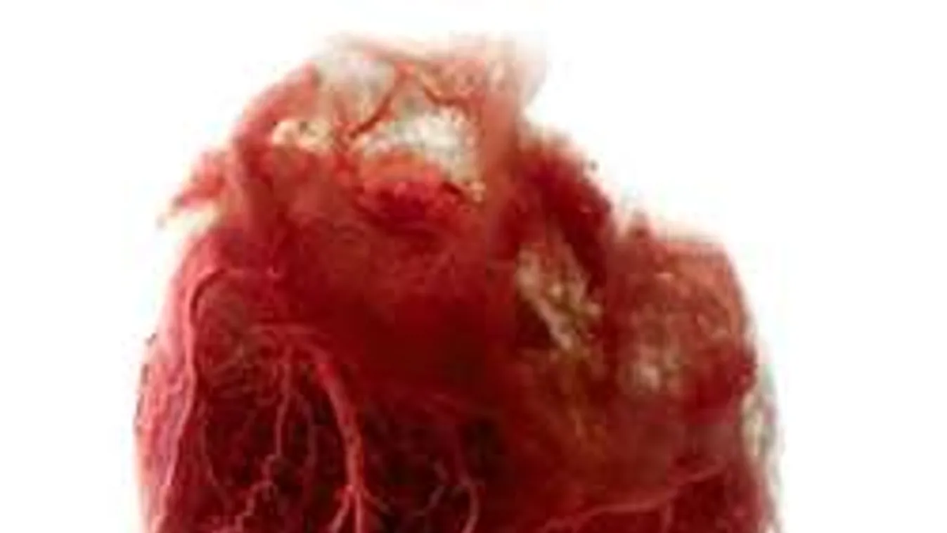 Döbbenetes videó: belülről is megnézheted, hogy dobog a szíved