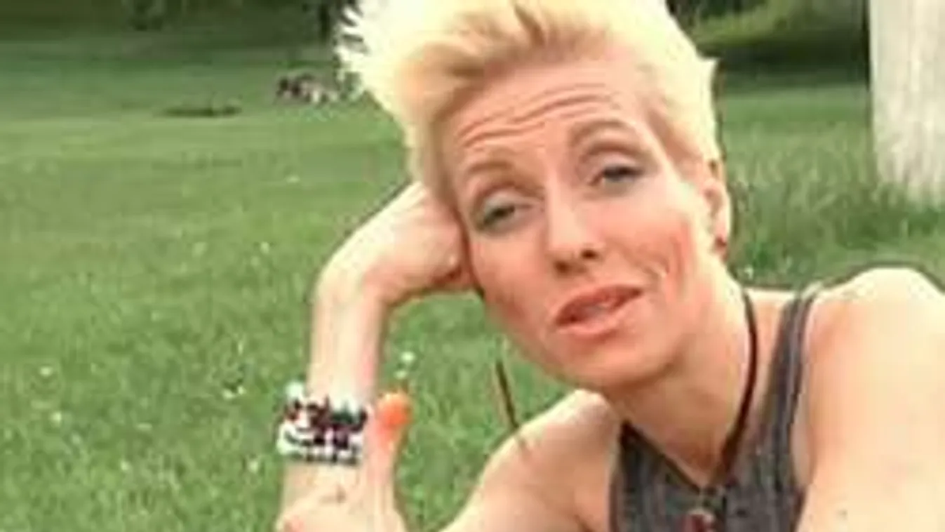 Nóci arcából elfogytak a zsírszövetek, sebész kell és aranyszál