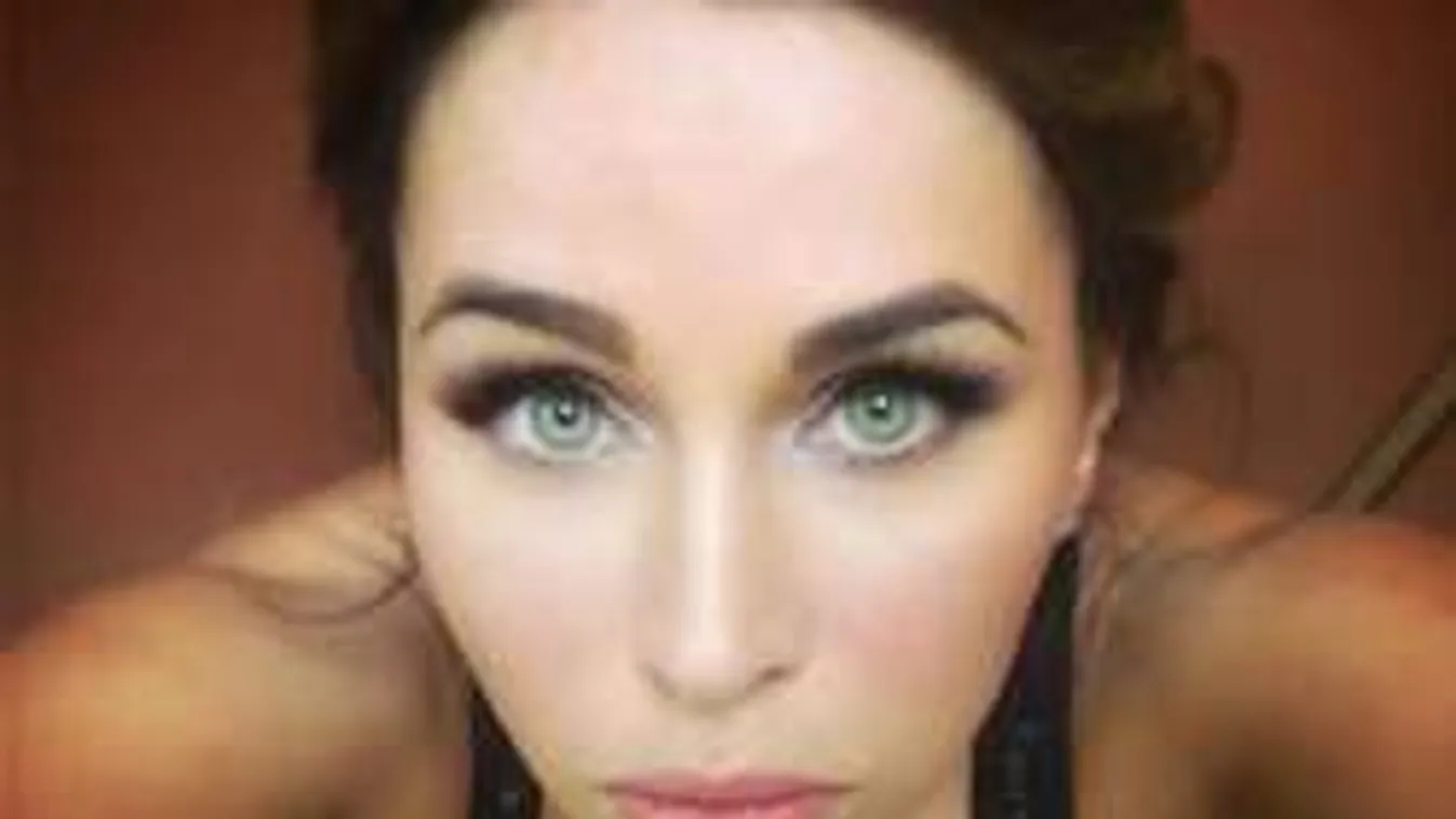 Rejtélyes sebhelyek borítják Aleska Diamond karját - Fotó