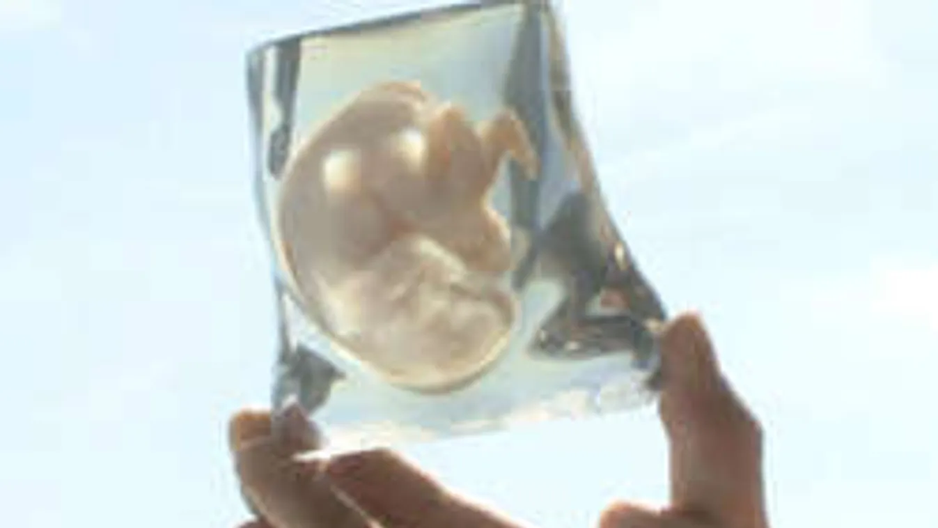 Magzatokat nyomtat egy cég!