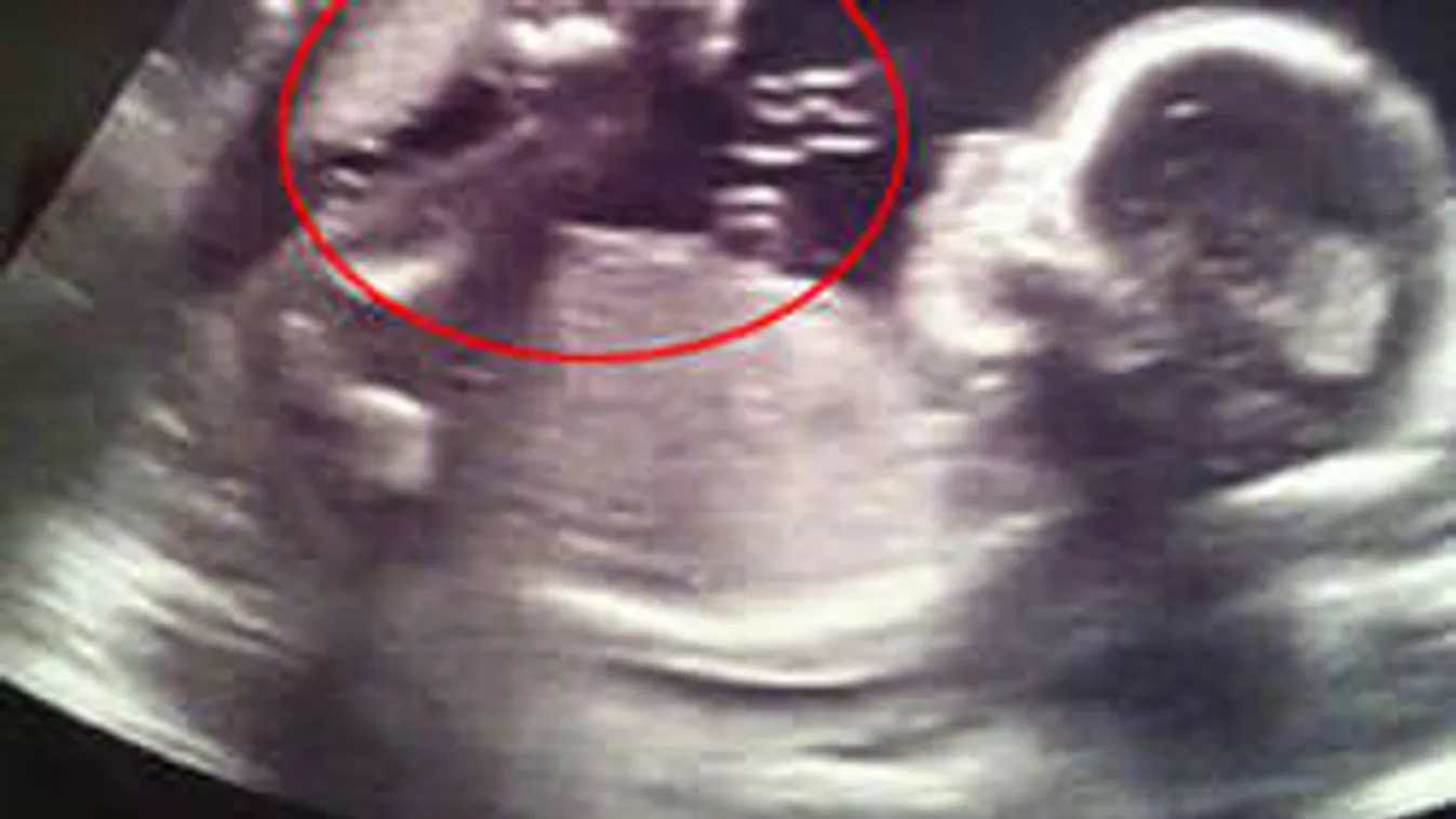 Újabb elképesztő terhességi ultrahang hozza lázba a világot! Kamu vagy csoda?