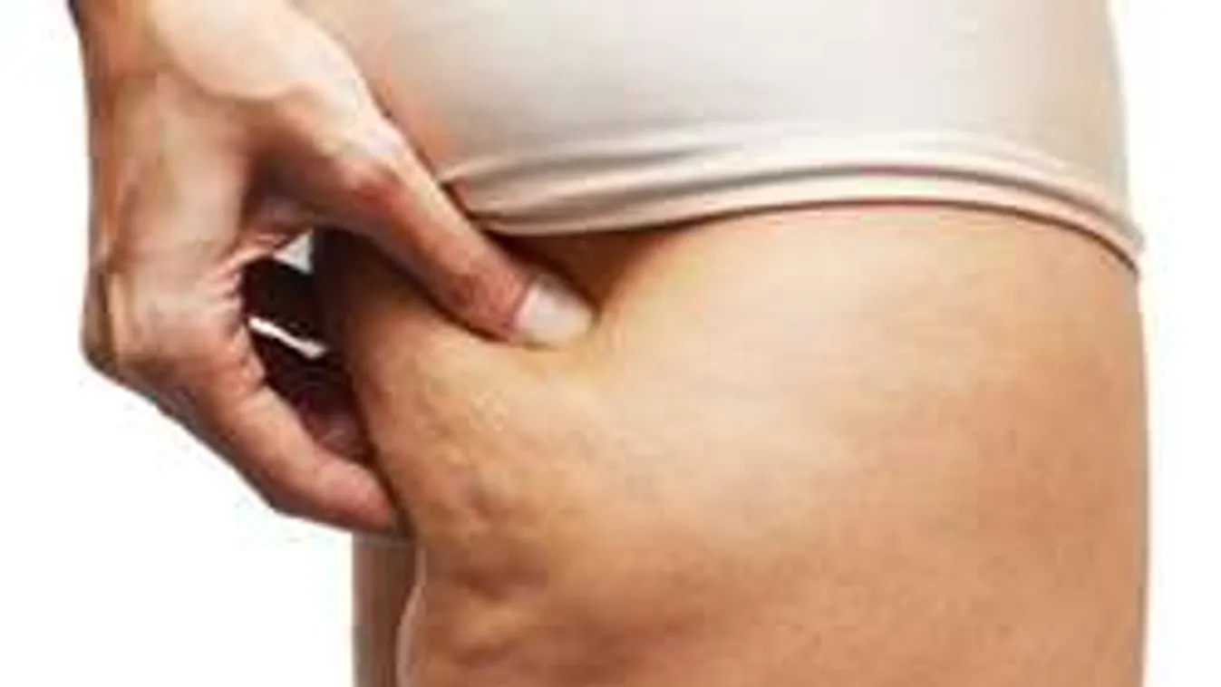 Soha többé narancsbőr! Ez a 10 étel tényleg eltünteti a popsidról a gödröcskéket!