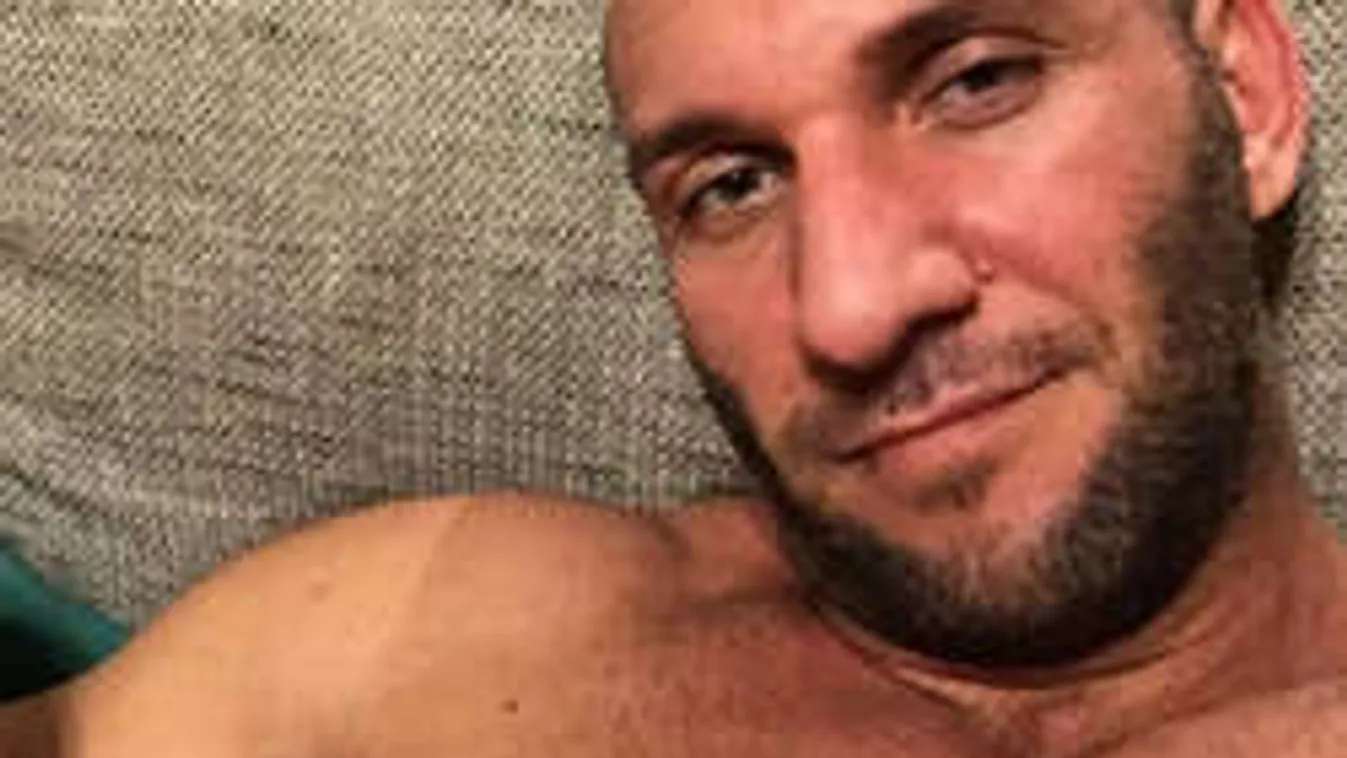 Mi történt Berki Krisztián arcával...? - FOTÓK