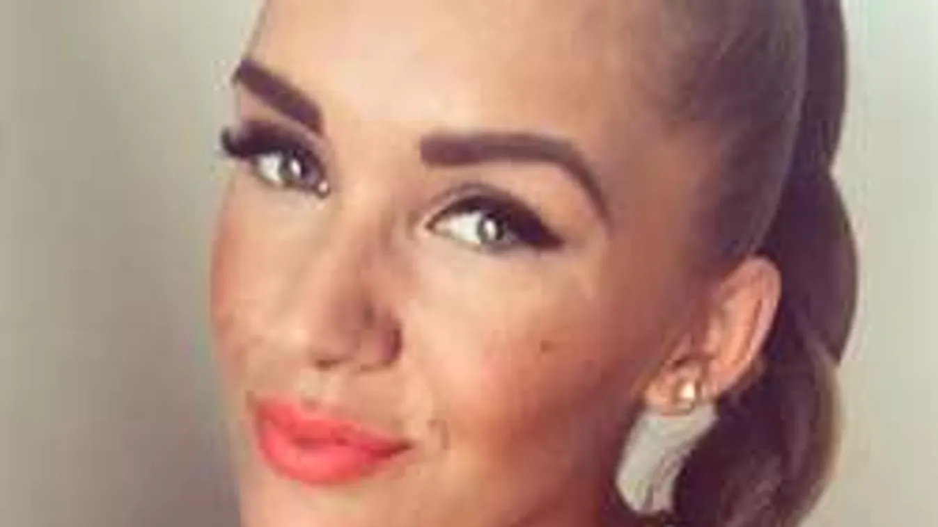 Hódi Pamela riasztó képet mutat, máris gyűjthet plasztikai sebészre?