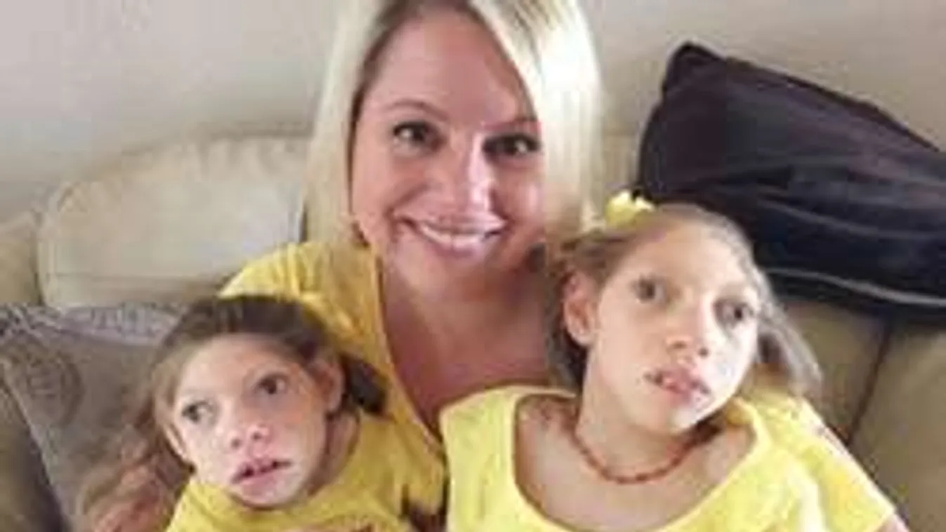 Ezt műveli a Zika-vírus: egy anyuka szívszorító története