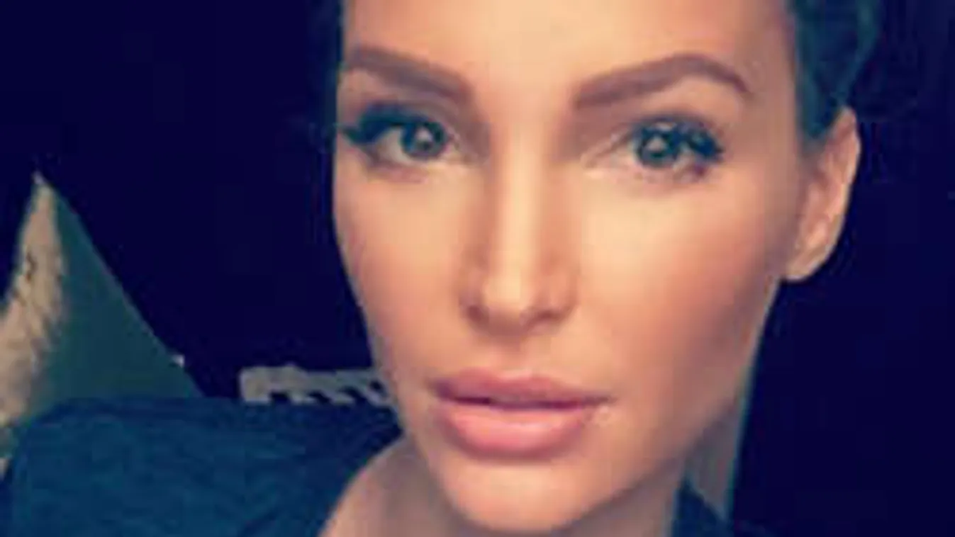 Hoppá! Mi történt Zimány Linda arcával?