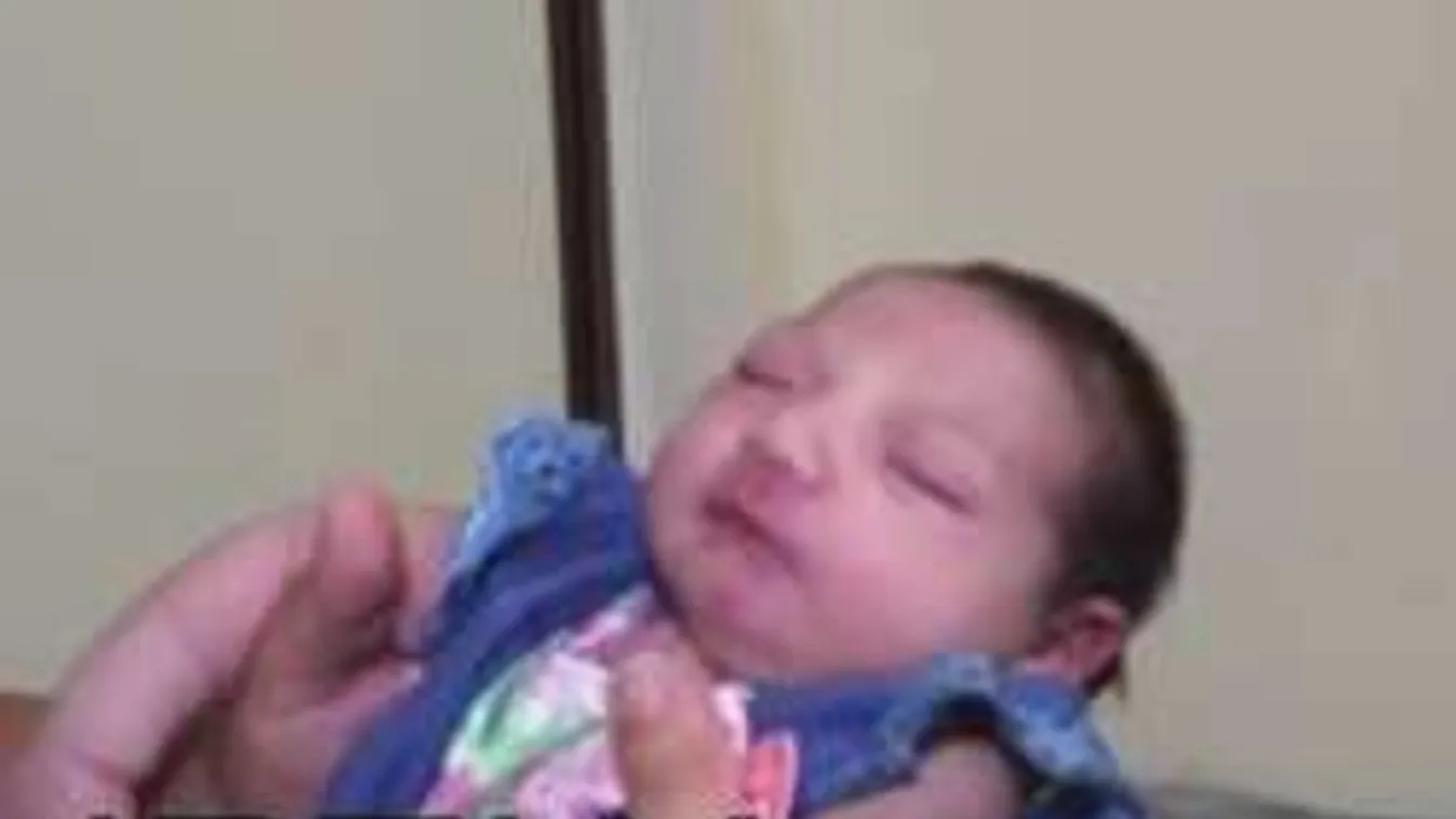 Videó egy kis fejű babáról, a Zika-vírus áldozatáról!