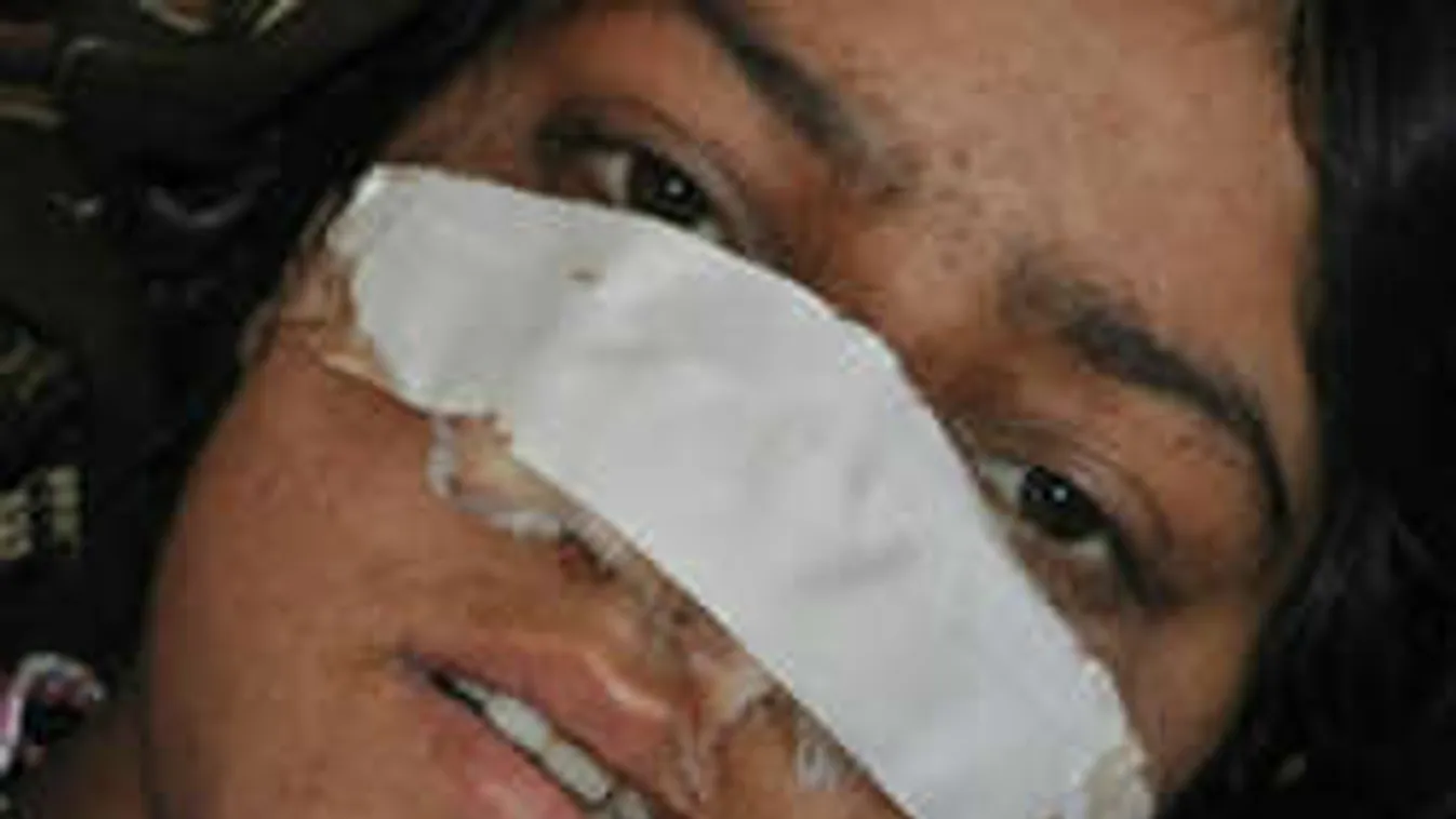 Levágta felesége orrát, mert az nem akarta áruba bocsátani 6 éves unokahúgát