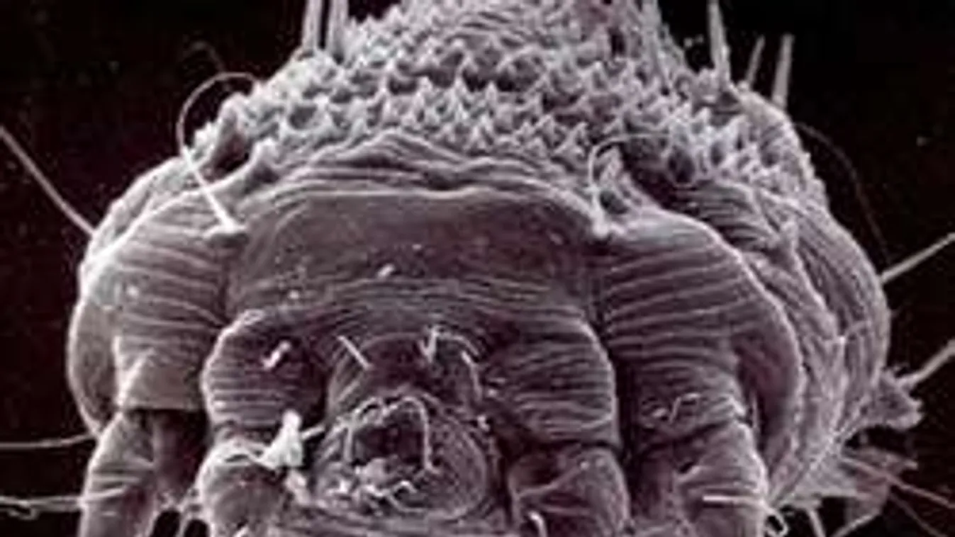 Rühök miatt kellett fertőtleníteni egy szekszárdi kollégiumot!