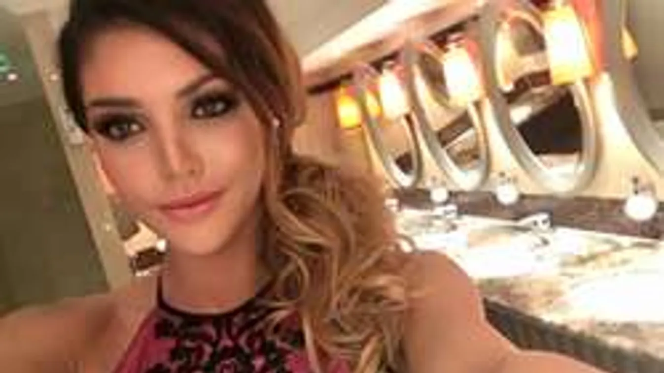 Komoly balesetet szenvedett a TV2 műsorvezetője