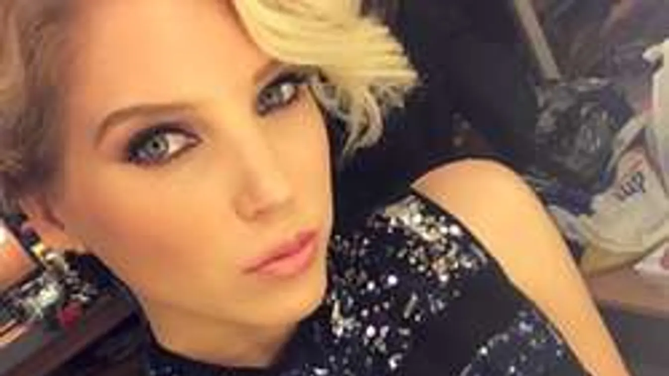 Mi történhetett Szabó Zsófi arcával? - Fotó