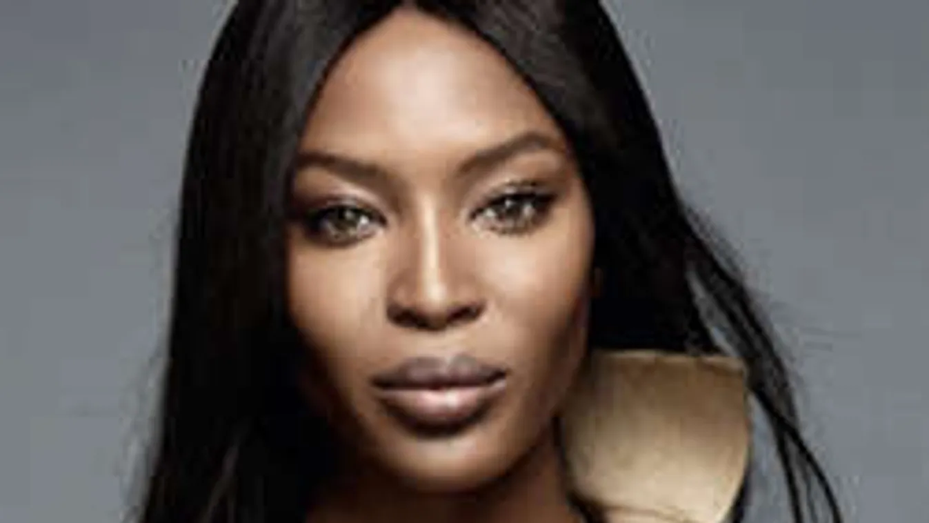 Kerekesszékbe került a világhírű topmodell - Fotó