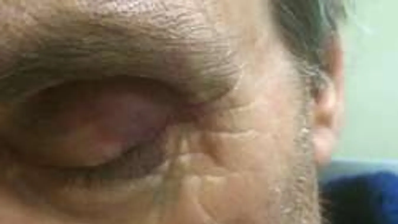 Brutálisan bántalmaztak egy idős beteget a pszichiátrián!