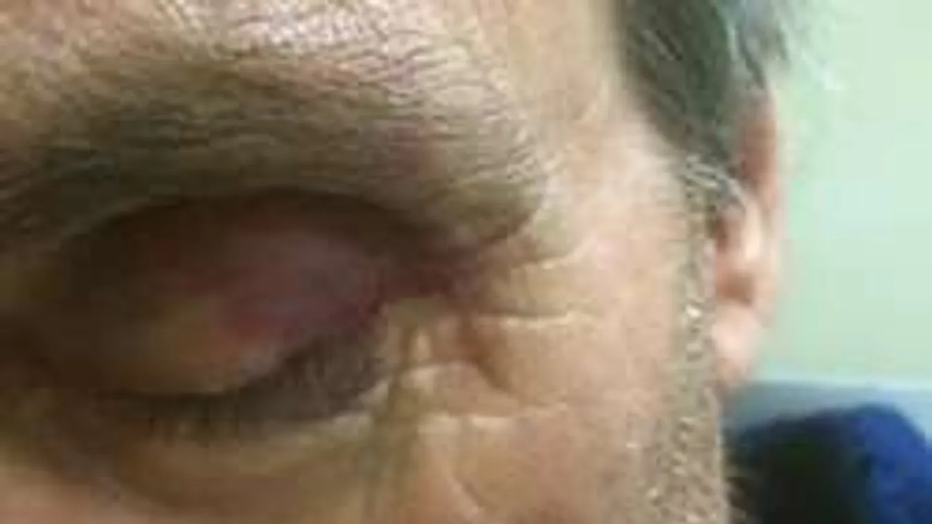 Botrány a pszichiátrián: Bosszút esküdött a megvert férfi lánya!