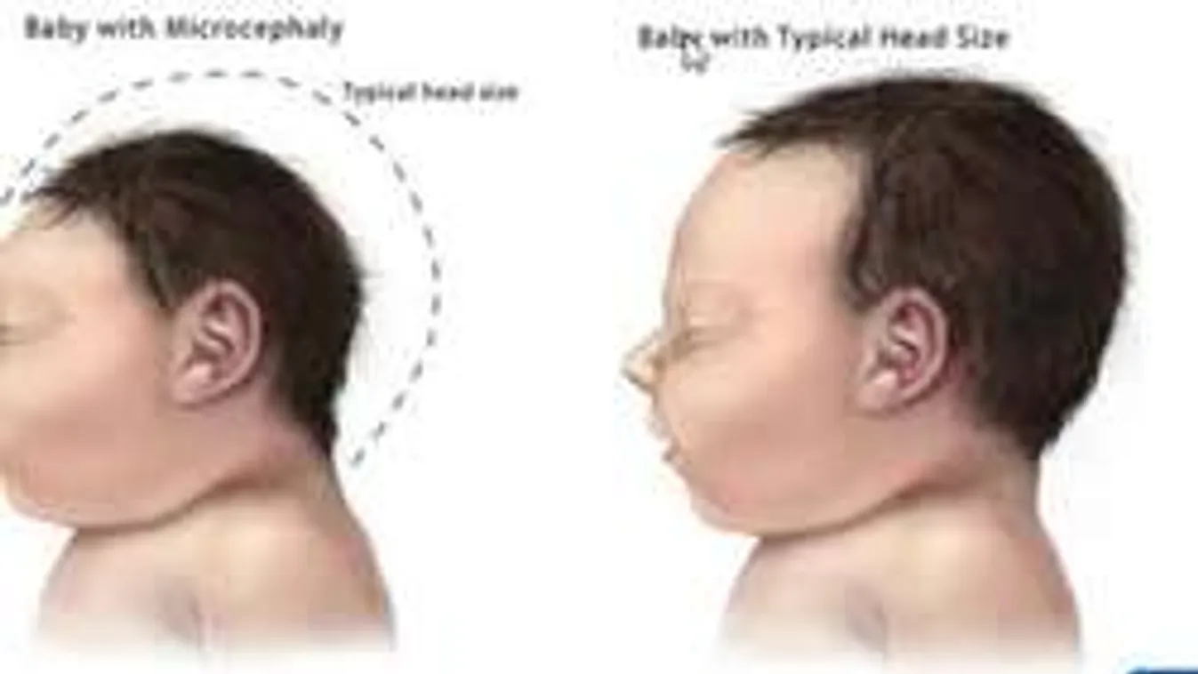 Kongatják a vészharangot: Kisfejűség-járványt indíthat a riói olimpia!