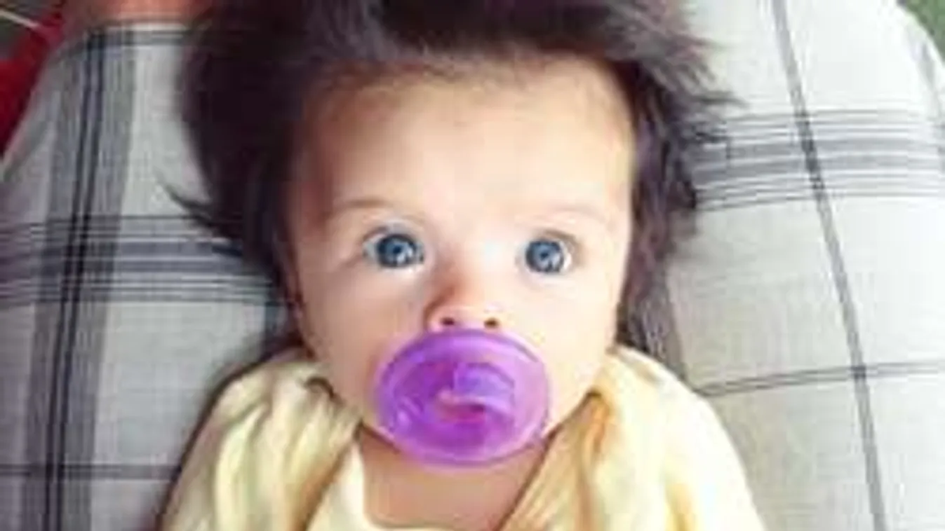 Világsztár lett ez a kisbaba! Te rájössz, miért döbben meg rajta mindenki?