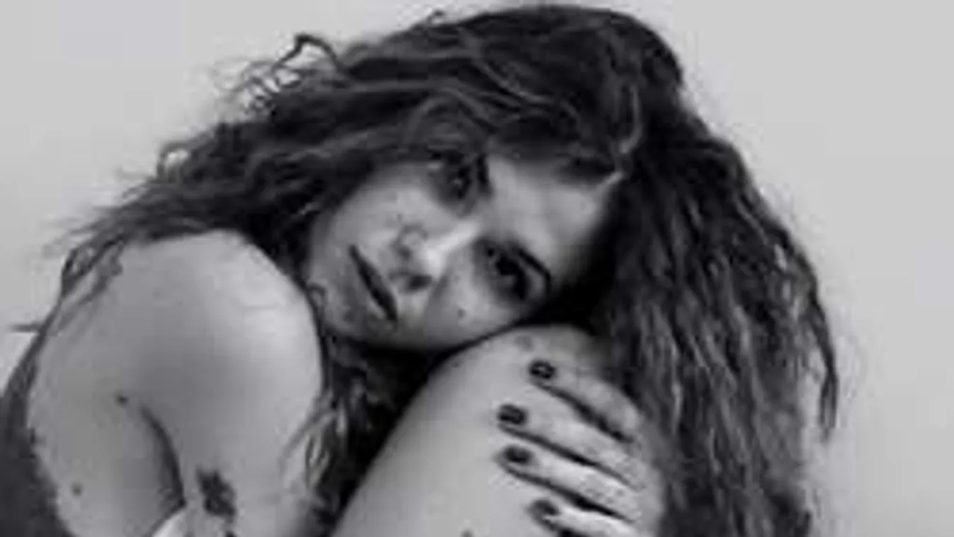 Bikiniben mutatta meg testét a génhibás modell - Fotók