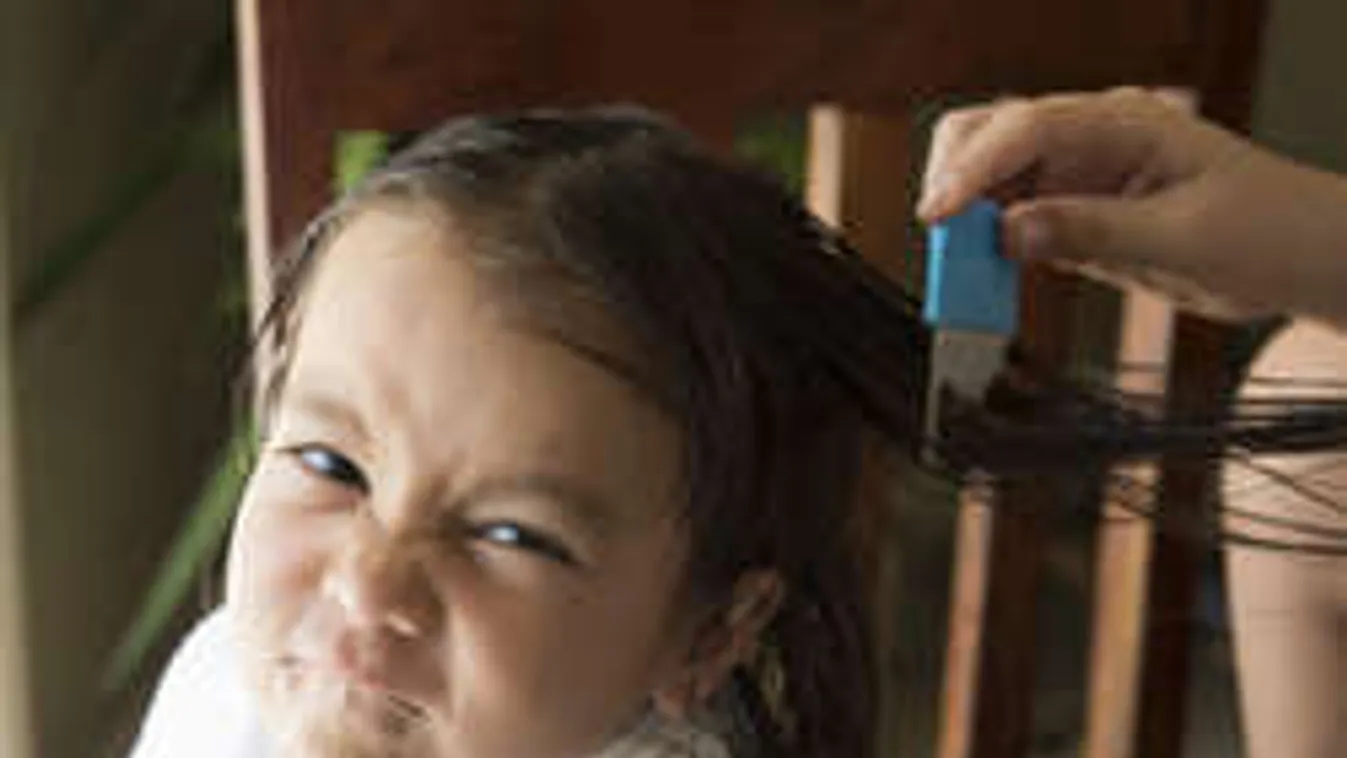 Nyári táborokból iskolába: Hamarosan berobban a tetűjárvány!