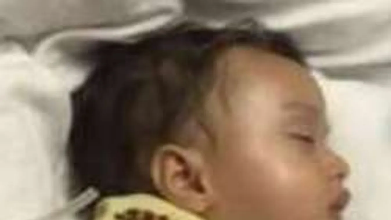 Hetekig szenvedett a kisbaba, a doktorok félrekezelték!