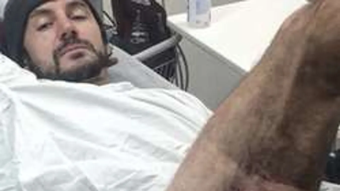 Elképesztő képek: ezt tette a biciklis lábával az iPhone - Fotók