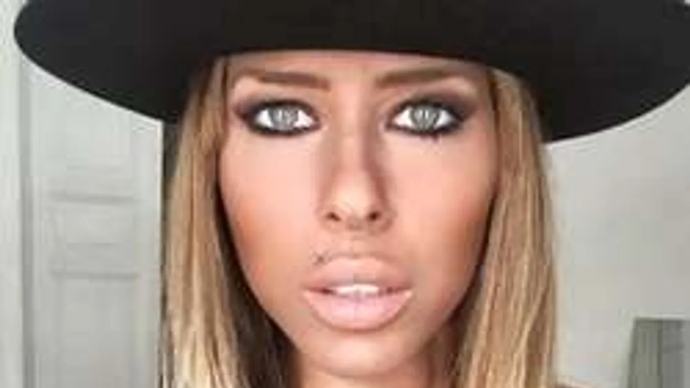 Aggódnak a TV2 csontsoványra fogyott egykori sztárjáért