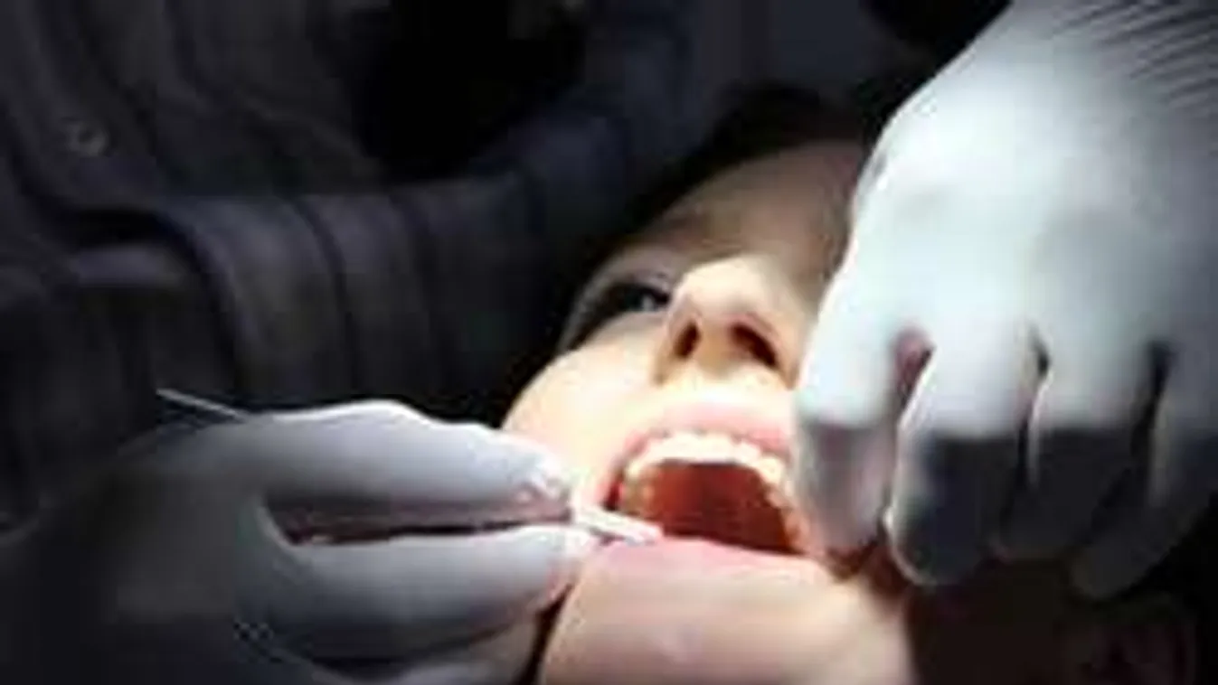 Mi lesz a fogsorunkkal? Beomolhat az állami fogorvosi ellátás