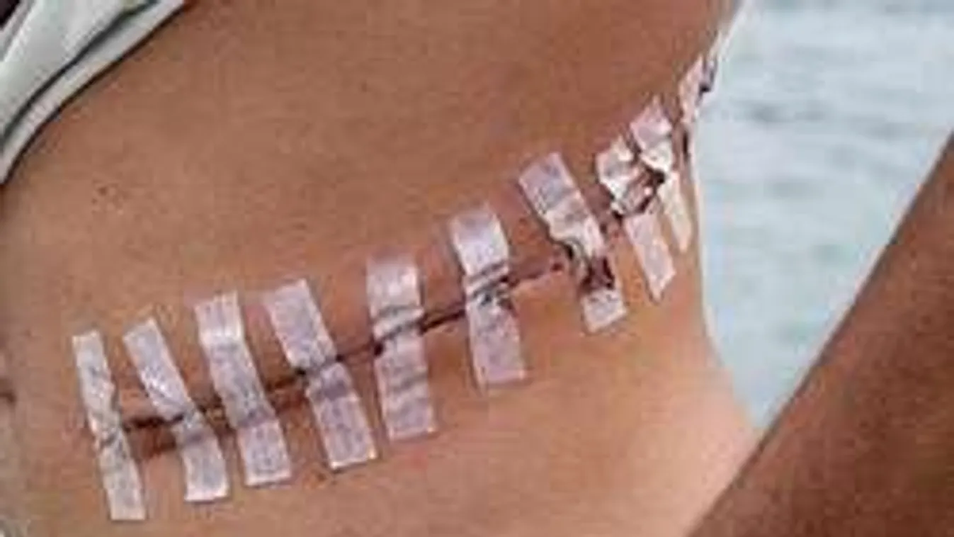 Horror! Halott vagy sebesült harcosaik szerveit árulja az ISIS!