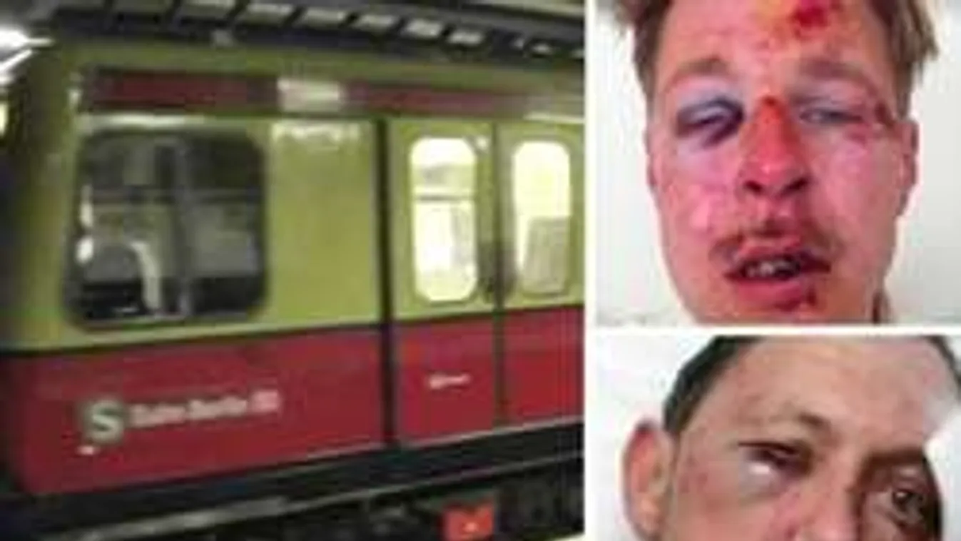 Brutális migránstámadás: kivert fogak, betört orrok az éjjeli járaton