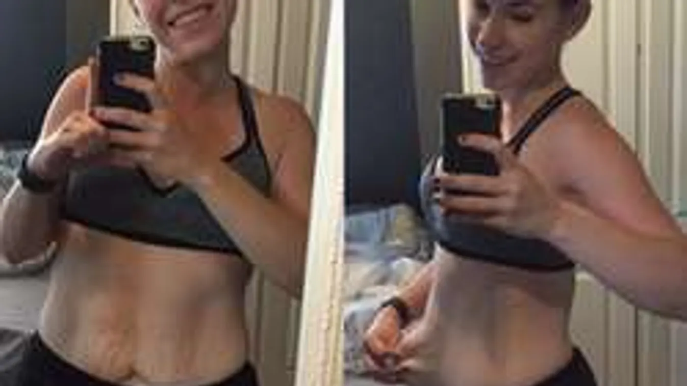 Íme az igazság, ez történik a bőröddel, ha túl sokat fogysz