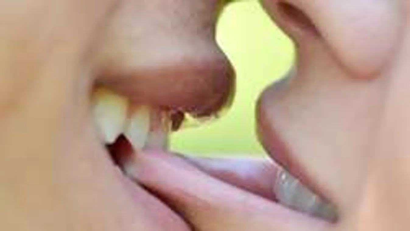 A férfiak 63, a nők 44 százalékával történt ez a legutóbbi szex során