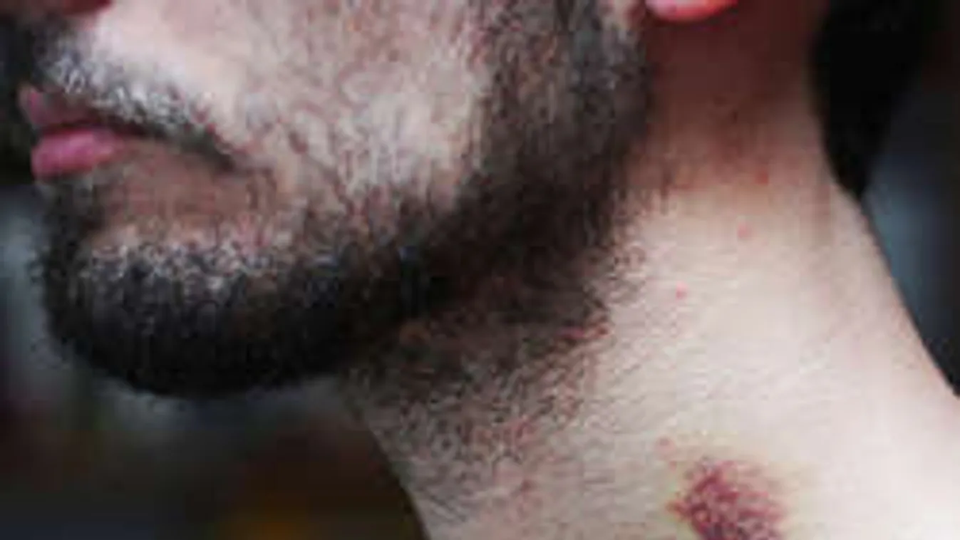 Misztikus szexbaleset: egyetlen csók végzett a fiatallal