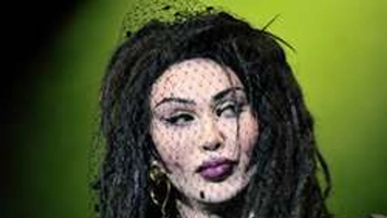 Majdnem belehalt a műtétbe a szörnnyé plasztikázott énekes!