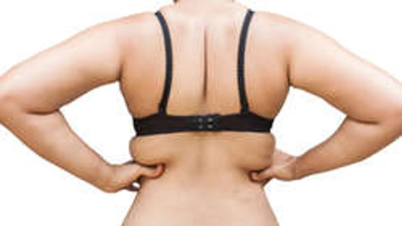 Tudtad, hogy 4 különböző háj létezik? Rád melyik rakódott?