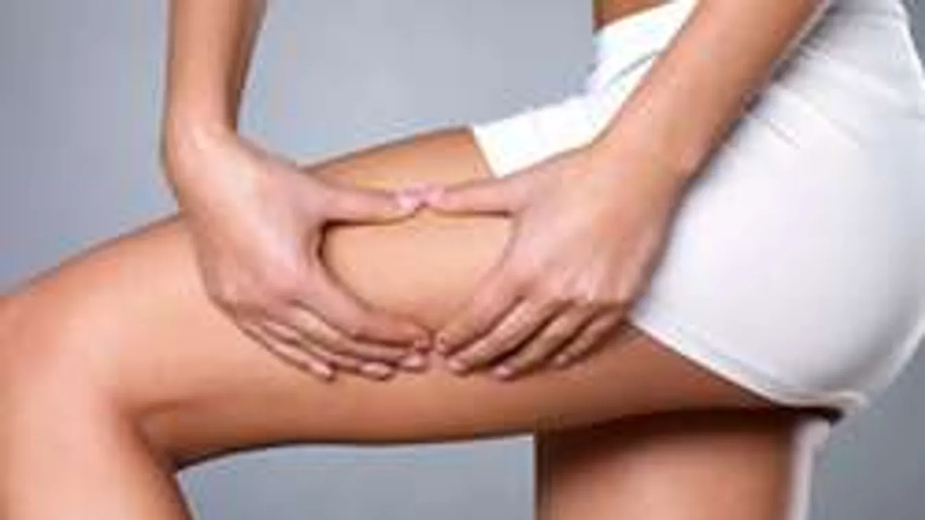 Totális támadás a narancsbőr ellen!