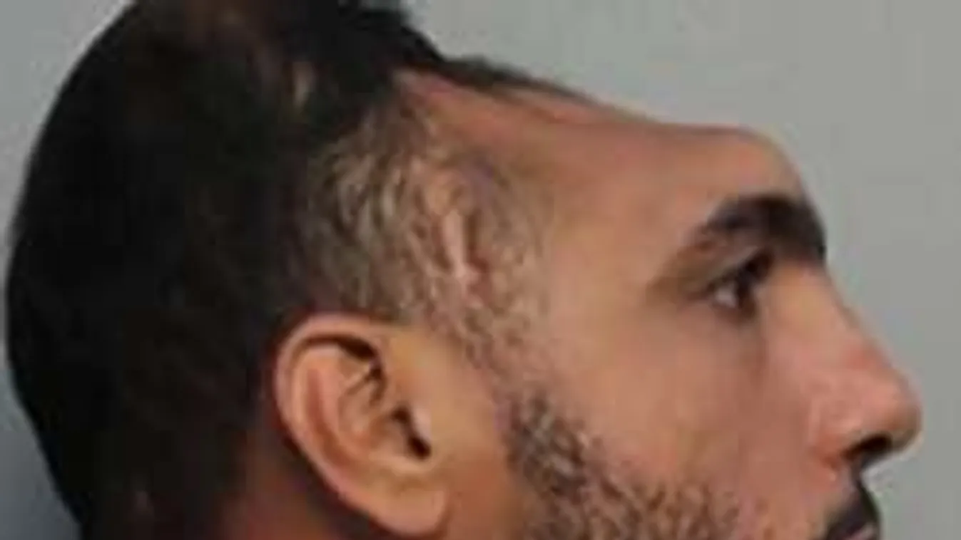 Lángoló matraccal akart gyilkolni a félfejű férfi