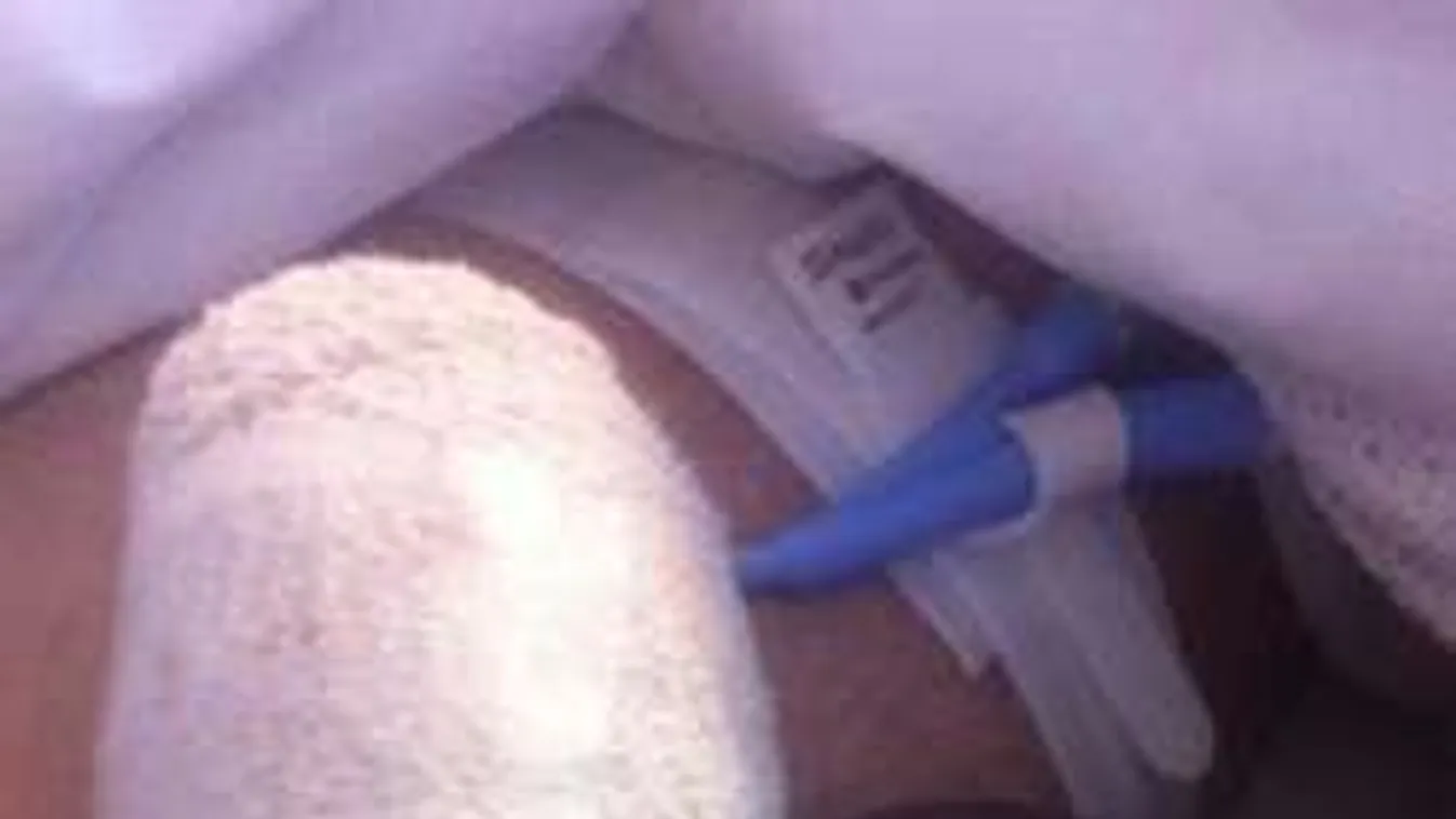 Atyaég! Kettétört a fickó férfiassága a vad szeretkezés közben! - Sokkoló fotók!