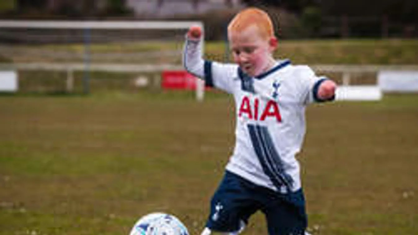 Megható! Végtagok nélkül sem adja fel a pici sportoló