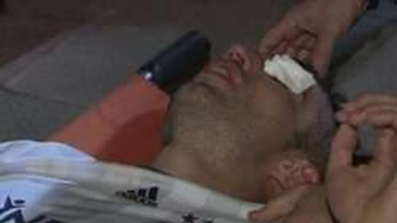 Pokoli sérülés, megvakulhat a világsztár focista