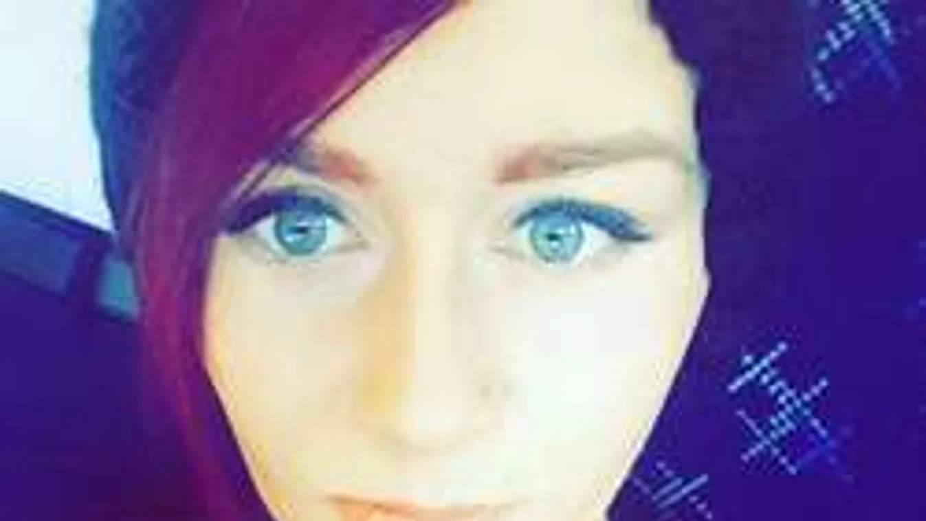 Húsevő baktérium miatt kellett levágni a gyönyörű modell mindkét lábát