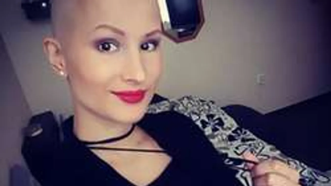 Szívszorító: súlyos betegségéről vallott a fiatal modell anyuka