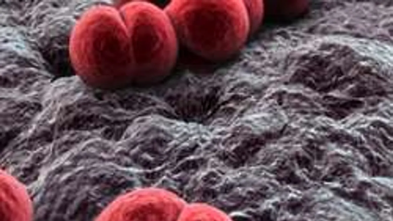 Agyhártyariadó: itt vannak az intő jelek