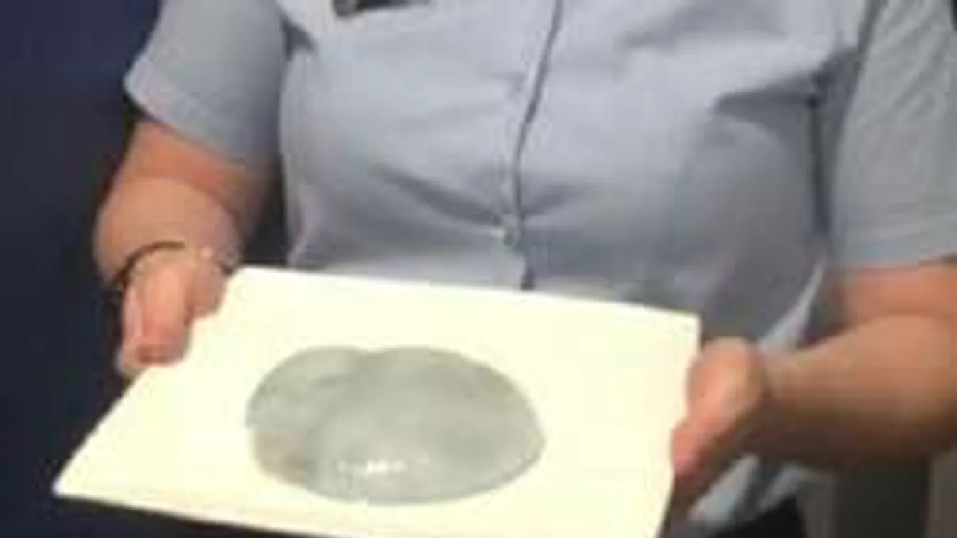 Műmellet talált a tengerparton, rendőrt hívott