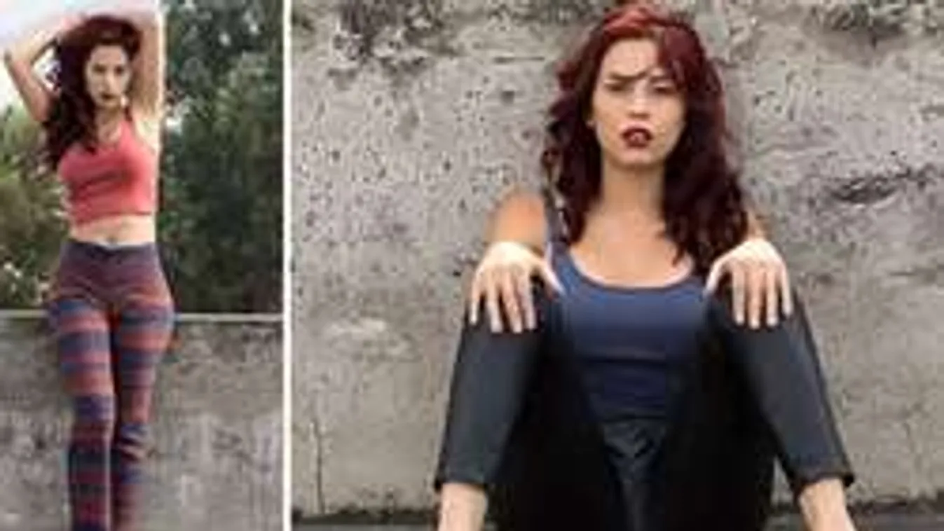 Tragédia: a vadító fiatal modell zsírleszívás közben halt meg